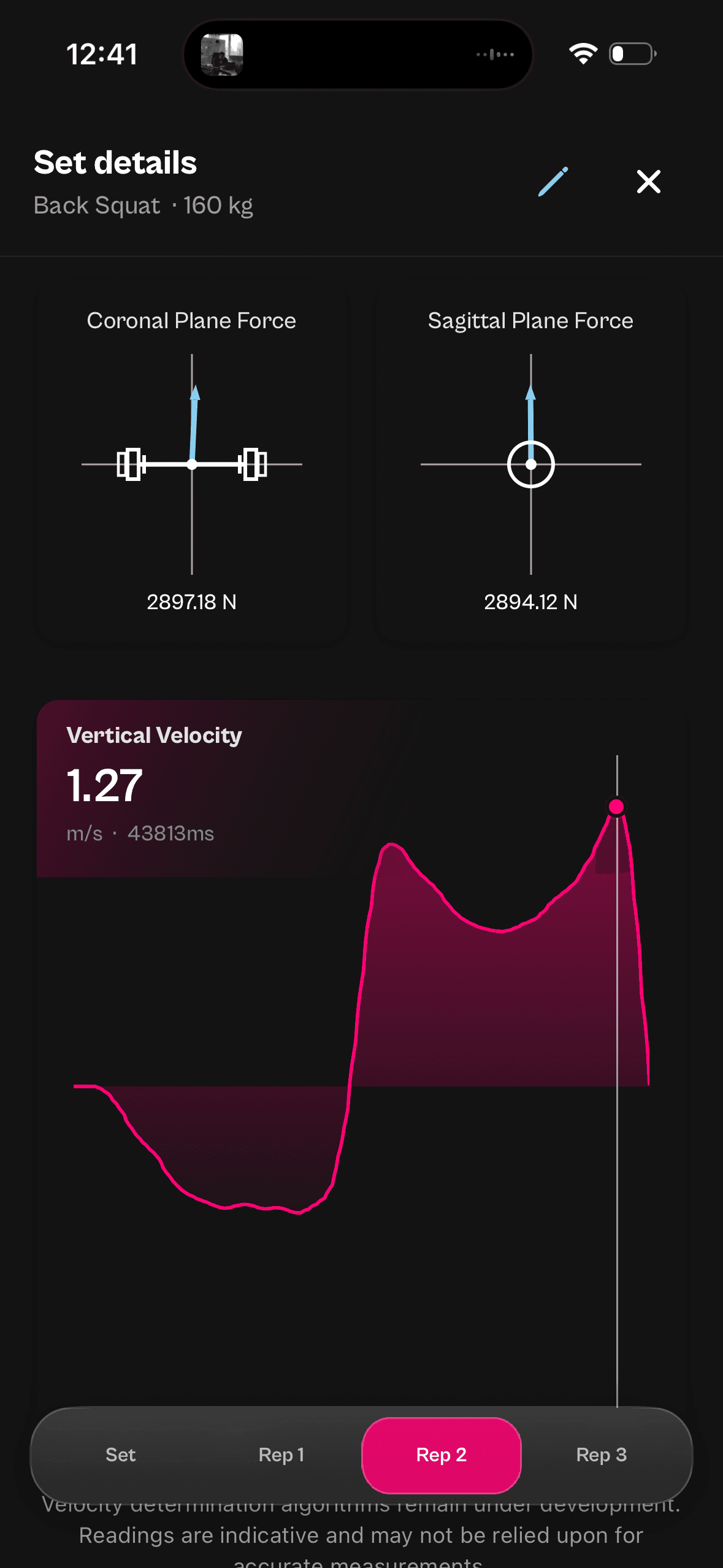 Velocity curve screen in the Kyna app